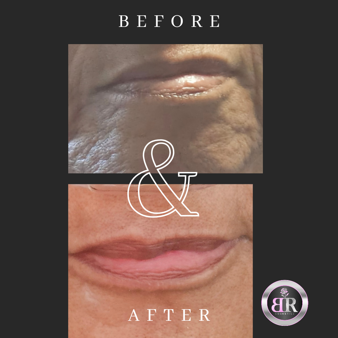 Before and after photo of a woman in her 50's showing visibly smoother skin and improved firmness around the mouth after using Bailee Rose Cosmetics Vitamin C Firming Serum